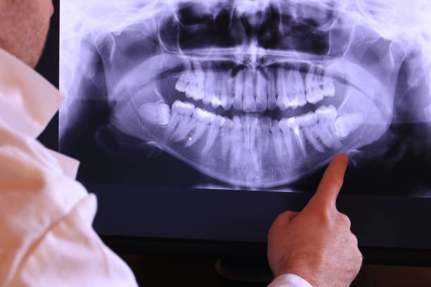 Best Emergency TMJ Treatment in Northwest Harwinton, CT